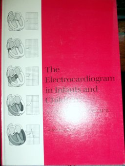 The Electrocardiogram in Infants and Children