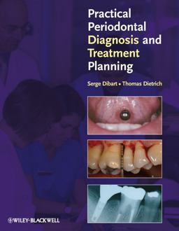 Practical Periodontal Diagnosis and Treatment Planning  9780813811840 Front Cover