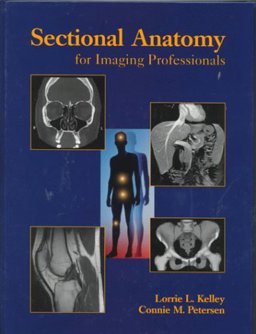 Sectional Anatomy for Imaging Professionals  9780815186656 Front Cover