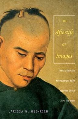 Afterlife of Images Translating the Pathological Body Between China and the West  9780822341130 Front Cover