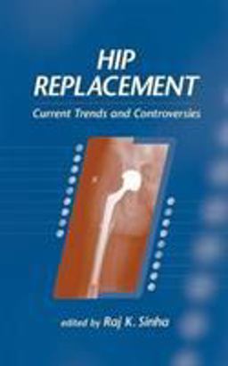 Hip Replacement Current Trends and Controversies  9780824707897 Front Cover