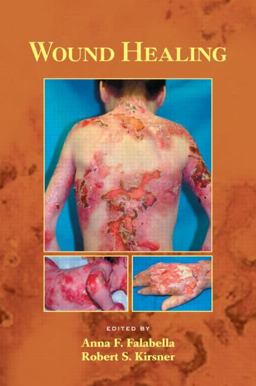 Wound Healing  9780824754587 Front Cover