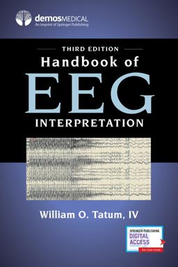 Handbook of Eeg Interpretation:  9780826147080 Front Cover