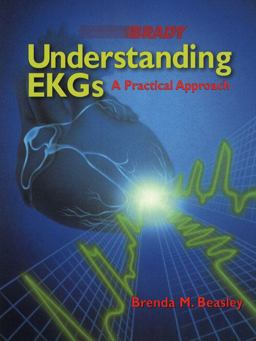Understanding EKGs A Practical Approach  9780835985710 Front Cover