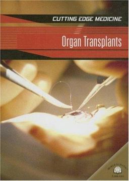 Organ Transplants