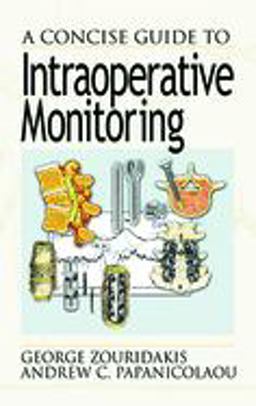 Concise Guide to Intraoperative Monitoring  9780849308864 Front Cover