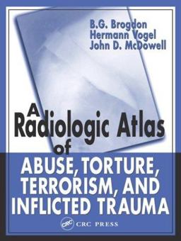 Radiologic Atlas of Abuse, Torture, Terrorism, and Inflicted Trauma  9780849315336 Front Cover