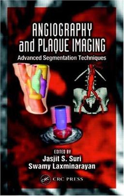 Angiography and Plaque Imaging