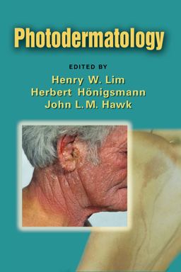 Photodermatology  9780849374968 Front Cover