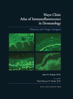 Mayo Clinic Atlas of Immunofluorescence in Dermatology Patterns and Target Antigens  9780849375729 Front Cover