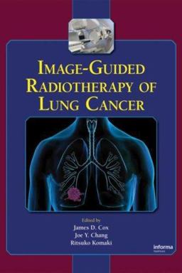 Image-Guided Radiotherapy of Lung Cancer Image-Guided Radiotherapy of Lung Cancer