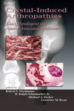Crystal-Induced Arthropathies Gout, Pseudogout and Apatite-Associated Syndromes  9780849393822 Front Cover