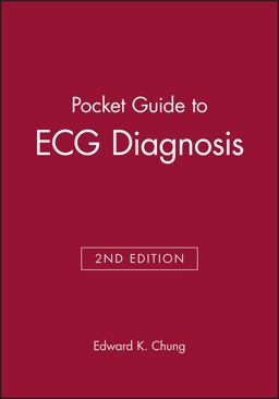 Pocket Guide to ECG Diagnosis 2nd 9780865425897 Front Cover