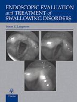 Endoscopic Evaluation and Treatment of Swallowing Disorders 2nd 9780865778382 Front Cover