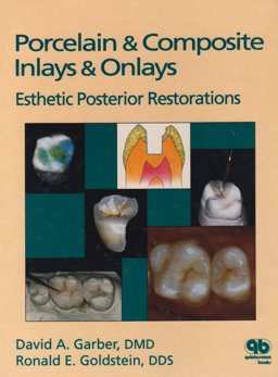 Porcelain and Composite Inlays and Onlays : Esthetic Posterior Restorations  9780867151718 Front Cover