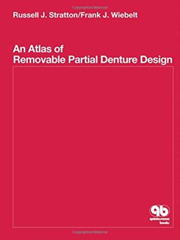 Atlas of Removable Partial Denture Design  9780867151909 Front Cover