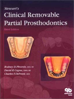 Stewart's Clinical Removable Partial Prosthodontics 3rd 9780867154177 Front Cover