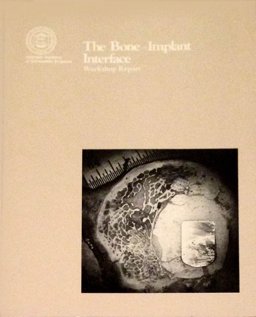 Bone Implant Interface