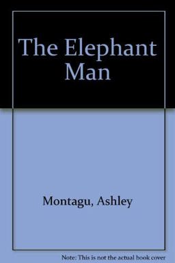 Elephant Man