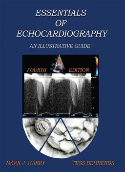 Essentials of Echocardiography An Illustrative Guide 4th 9780989428002 Front Cover