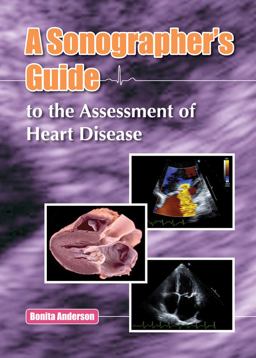 Sonographer's Guide to the Assessment of Heart Disease  9780992322205 Front Cover