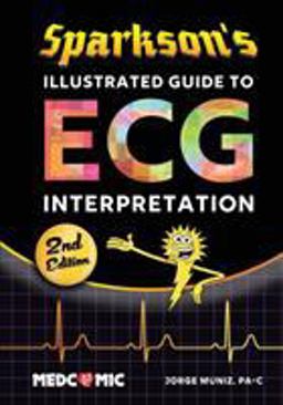 Sparkson's Illustrated Guide to ECG Interpretation, 2nd Edition  9780996651370 Front Cover