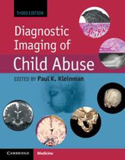 Diagnostic Imaging of Child Abuse 3rd 9781107010536 Front Cover