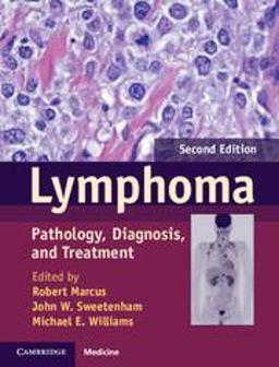 Lymphoma Lymphoma