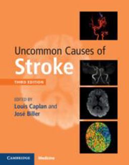 Uncommon Causes of Stroke 3rd 9781107147447 Front Cover