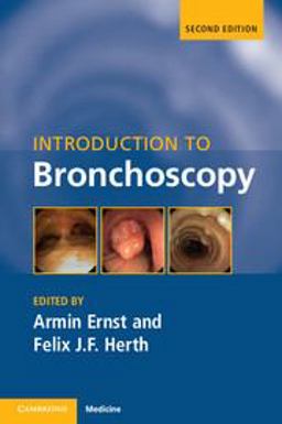 Introduction to Bronchoscopy 2nd 9781107449527 Front Cover