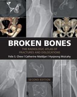 Broken Bones The Radiologic Atlas of Fractures and Dislocations 2nd 9781107499232 Front Cover