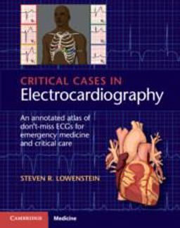 Critical Cases in Electrocardiography An Annotated Atlas of Don't-Miss ECGs for Emergency and Critical Care  9781107535916 Front Cover