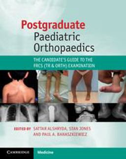 Postgraduate Paediatric Orthopaedics The Candidate's Guide to the FRCS (Tr and Orth) Examination  9781107644588 Front Cover