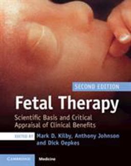 Fetal Therapy Scientific Basis and Critical Appraisal of Clinical Benefits 2nd 9781108474061 Front Cover