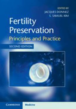 Fertility Preservation Principles and Practice 2nd 9781108494595 Front Cover