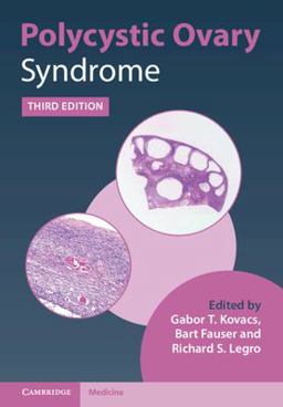 Polycystic Ovary Syndrome 3rd 9781108839334 Front Cover