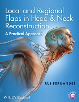 Local and Regional Flaps in Head and Neck Reconstruction A Practical Approach  9781118340332 Front Cover