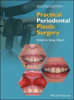 Practical Periodontal Plastic Surgery 2nd 9781118360651 Front Cover
