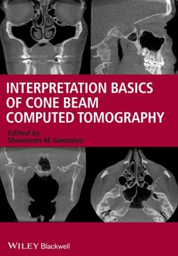 Interpretation Basics of Cone Beam Computed Tomography  9781118381069 Front Cover