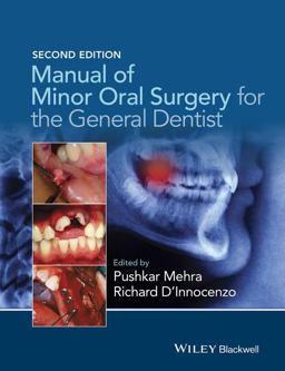 Manual of Minor Oral Surgery for the General Dentist 2nd 9781118432150 Front Cover