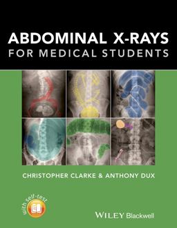 Abdominal X-Rays for Medical Students  9781118600559 Front Cover