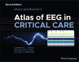 Hirsch and Brenner's Atlas of EEG in Critical Care 2nd 9781118752890 Front Cover