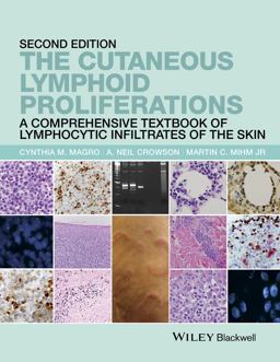 Cutaneous Lymphoid Proliferations A Comprehensive Textbook of Lymphocytic Infiltrates of the Skin 2nd 9781118776261 Front Cover