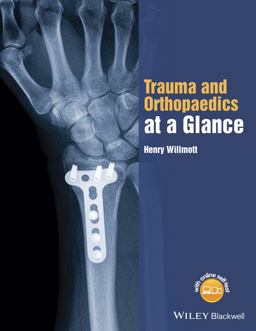Trauma and Orthopaedics at a Glance  9781118802533 Front Cover