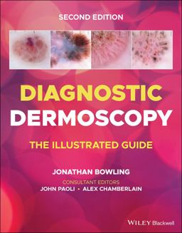 Diagnostic Dermoscopy The Illustrated Guide 2nd 9781118930489 Front Cover