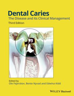 Dental Caries The Disease and Its Clinical Management 3rd 9781118935828 Front Cover