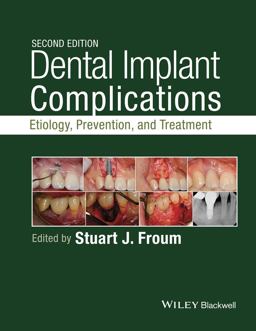 Dental Implant Complications: Etiology, Prevention, and Treatment  9781118976456 Front Cover