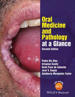 Oral Medicine and Pathology at a Glance 2nd 9781119121343 Front Cover