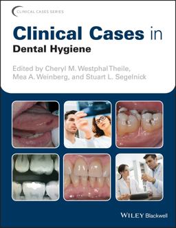 Clinical Cases in Dental Hygiene  9781119145028 Front Cover