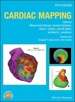 Cardiac Mapping Cardiac Mapping